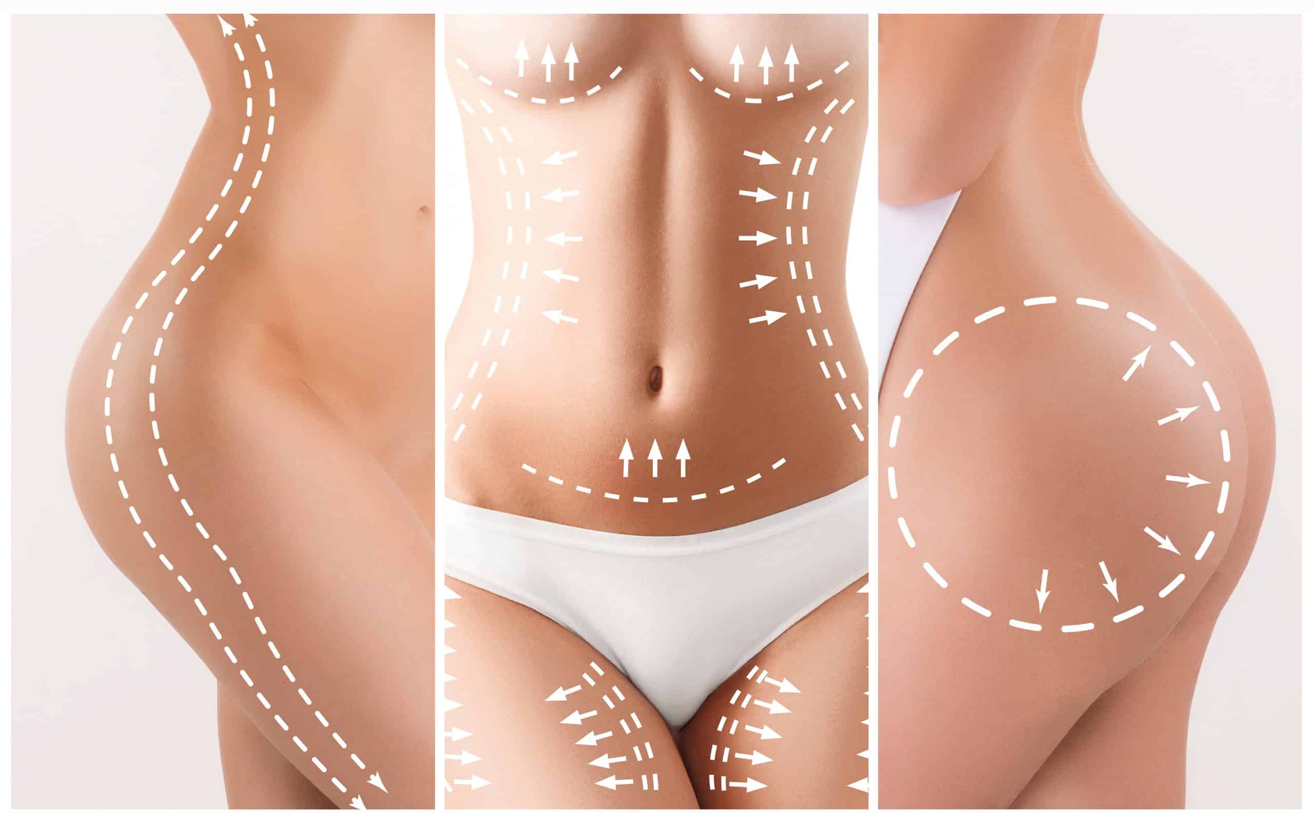 Combined procedures